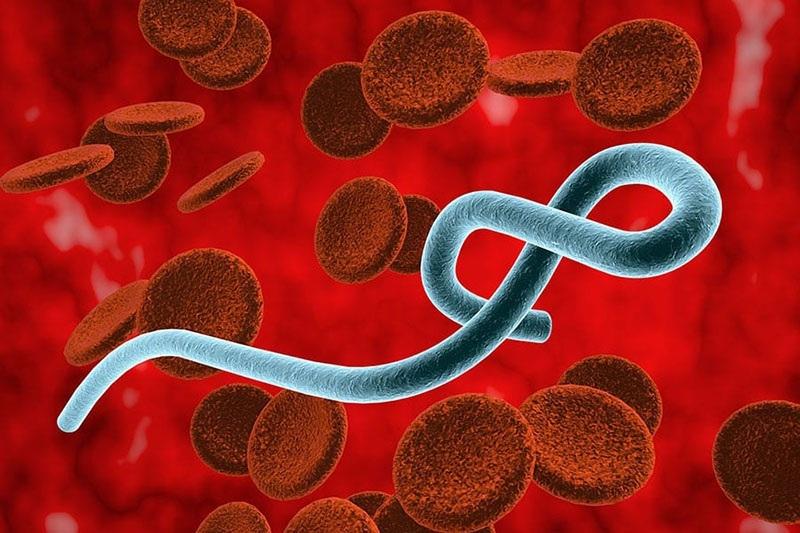 Hình ảnh virus Ebola. Ảnh: medlatec.vn