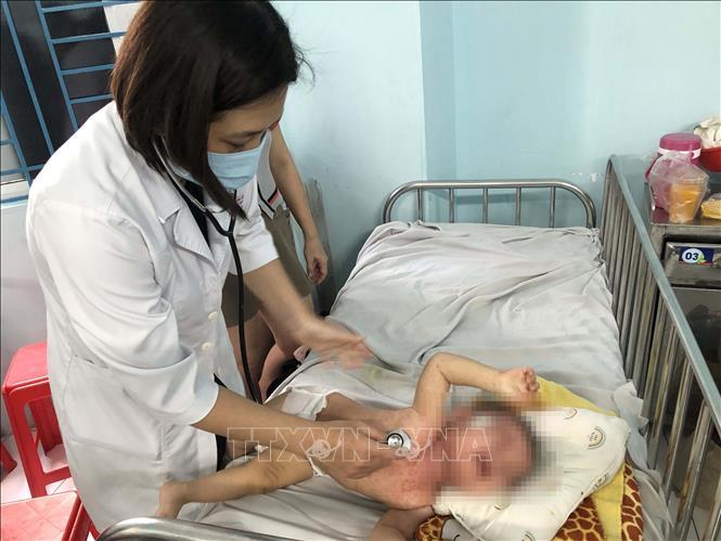 Các địa phương chuẩn bị kỹ càng để triển khai Chiến dịch tiêm chủng vaccine sởi