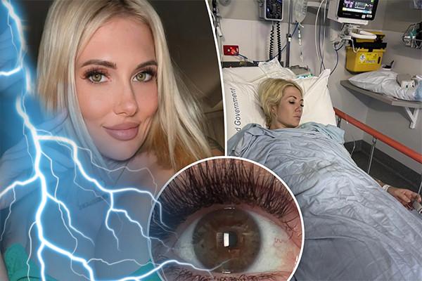 Người phụ nữ có đôi mắt đổi màu sau khi bị sét đánh