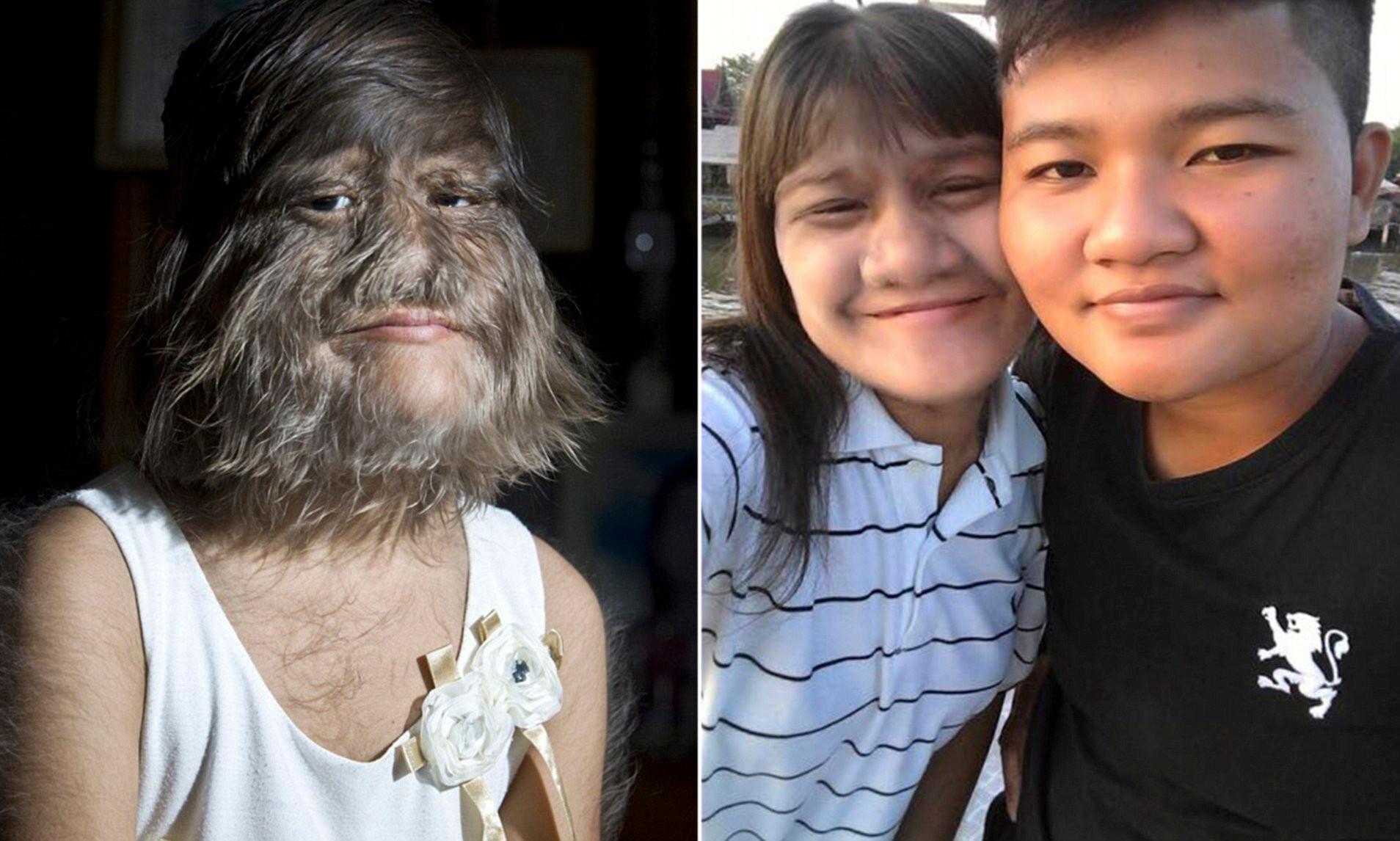 Cô gái 'nhiều lông nhất thế giới' tìm được tình mới sau đổ vỡ hôn nhân