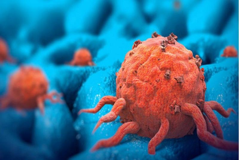 Ung thư là một bệnh nguy hiểm. Ảnh minh hoạ