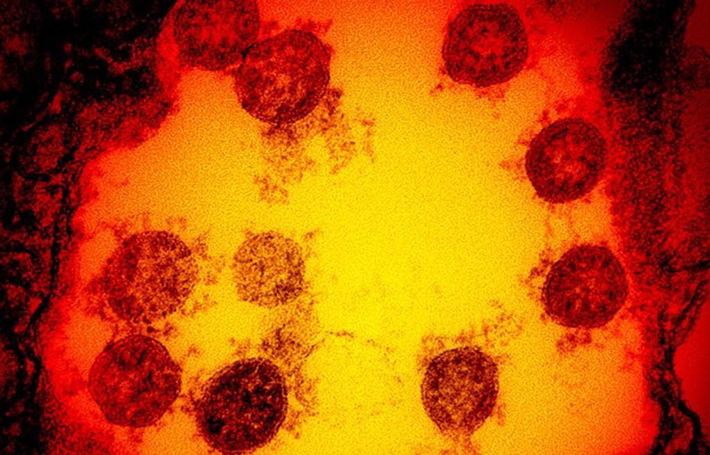 Nghiên cứu mới về thời gian virus SARS-CoV-2 tồn tại trên da người