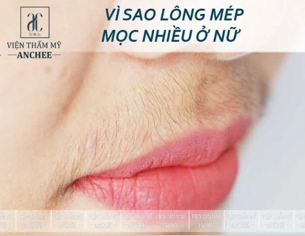 Triệt lông mép tại nhà an toàn, hiệu quả