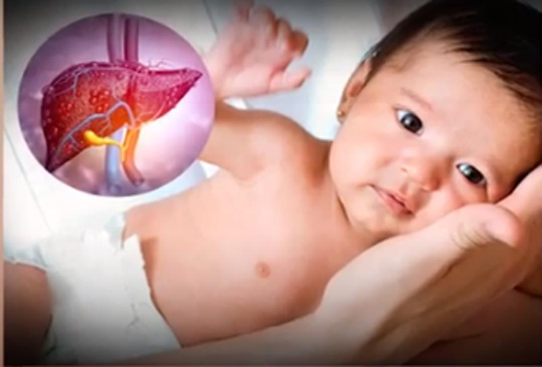 Viêm gan cấp tính xảy ra ở trẻ em có triệu chứng như thế nào?