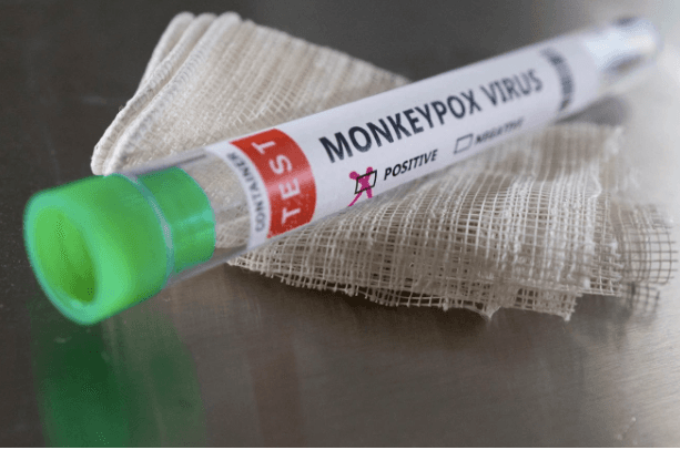 11 dấu hiệu và những cấp độ bệnh đậu mùa khỉ