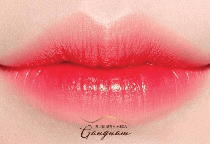 Phun môi collagen tại Mega Gangnam - công nghệ làm đẹp vượt trội