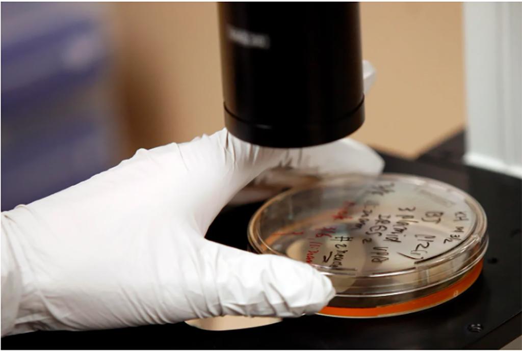 Thêm hy vọng về khả năng chữa khỏi bệnh HIV/AIDS