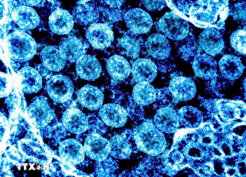 Đột phá trong sử dụng tế bào gốc phôi người để điều trị COVID-19