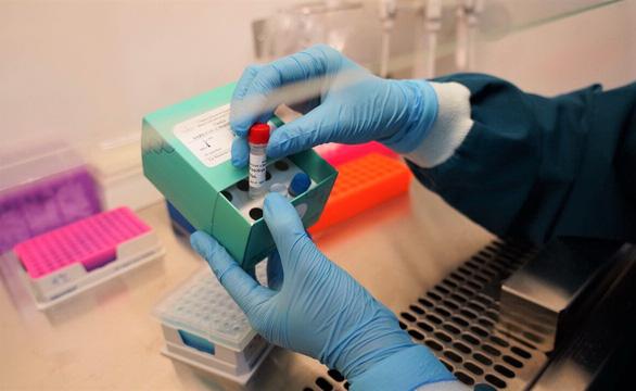 Vinmec phát triển thành công 2 bộ kit xét nghiệm virus corona