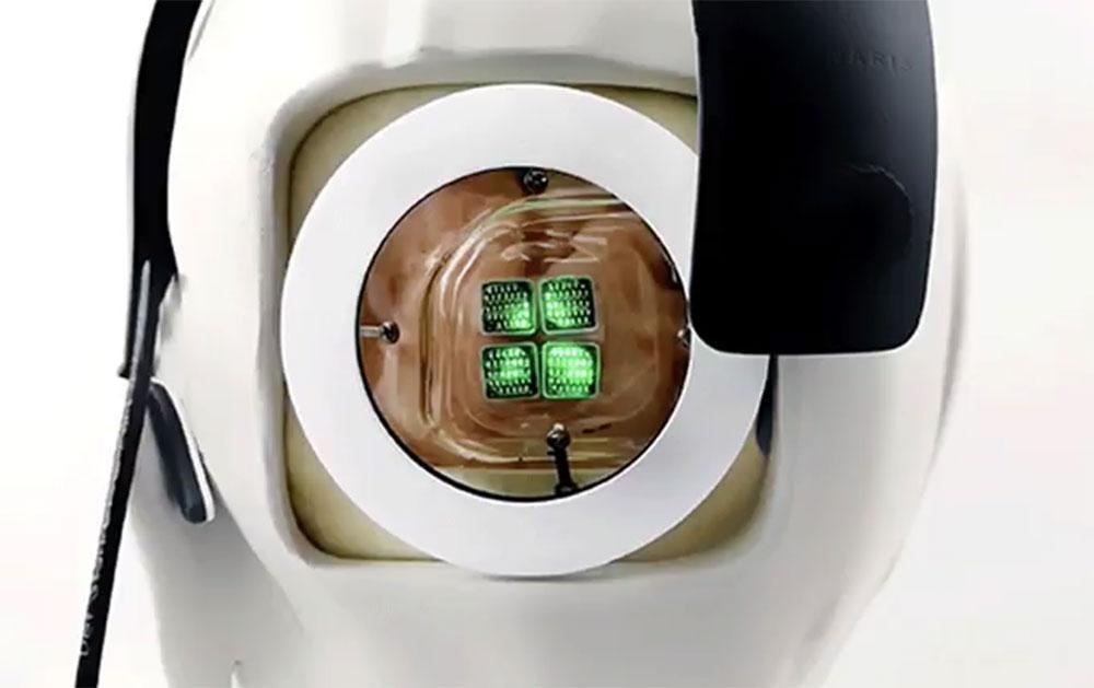 Thiết bị cấy vỏ não hồi phục thị lực người mù