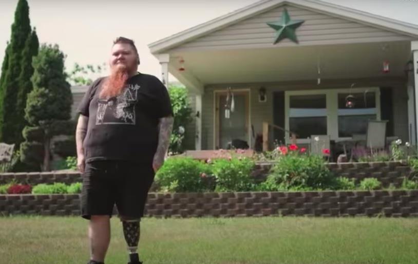 Căn bệnh khiến người phụ nữ có bộ râu dài nhất thế giới