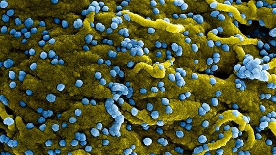 WHO tăng cường giám sát sau khi Guinea Xích đạo công bố dịch bệnh do vi-rút Marburg