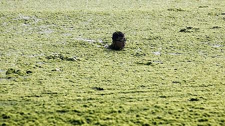 Phát hiện virus khiến con người bị ngớ ngẩn