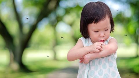 Xử trí dị ứng do côn trùng đốt
