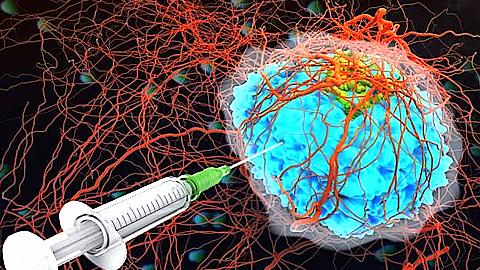 Mỹ thử nghiệm thành công loại "keo dán" trong điều trị ung thư