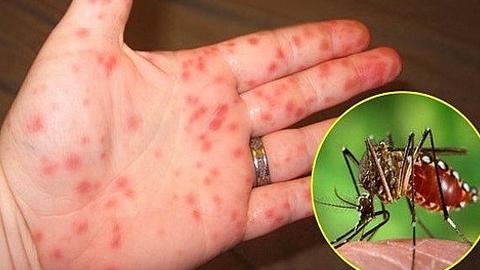 Ngừa các bệnh gia tăng đầu hè