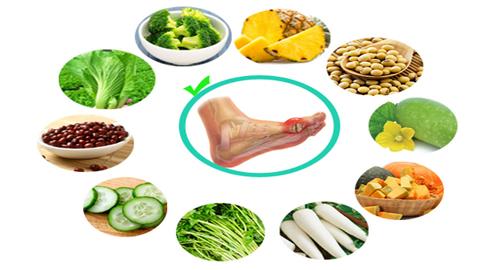 8 cách giảm axit uric không dùng thuốc